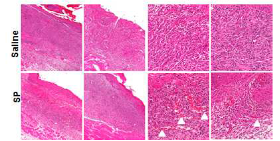 Ischemic ulcer에 대한 SP의 영향을 조직학적으로 분석