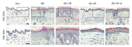 조직학적 분석을 통한 SP에 의한 표피 이상 증식 억제 확인