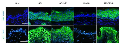 면역 형광 염색 방법을 통한 이상 증식 표지자인 Keratin 6, Keratin 17이 SP 처리군에서는 감소된 발현 확인
