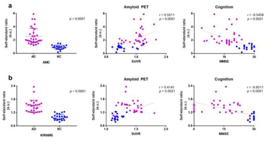 혈액 기반 바이오마커와 아밀로이드 정량 검사, 인지기능 검사 간 연관성. (좌측 열) 혈액기반 바이오마커 (self-standard ratio) 기반 알츠하이머병과 정상인의 구분 (중앙 열) 아밀로이드 PET 검사의 정량분석 결과와 혈액기반 바이오마커간의 상관관계 (우측 열) MMSE로 평가된 인지기능과 혈액기반 바이오카머간의 상관관계. (a) 서울아산병원 (AMC); (b) 원자력 의학원 (KIRAMS) 약자: NC, normal cognition; AD, Alzheimer’s disease; MMSE, Mini-Mental State Examination; SUVR, Standardized Uptake Value Ratio