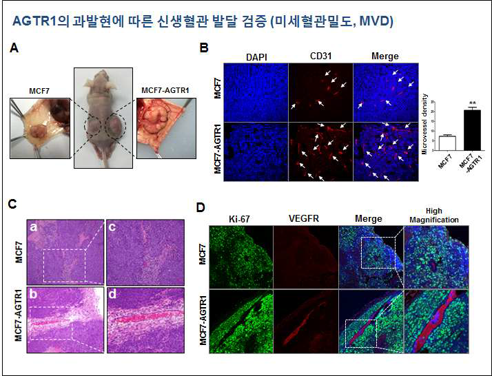 AGTR1 과발현이 신생혈관 형성을 촉진 A. Xenograft mouse model에서 AGTR1 과발현에 따른 신생혈관 형성 여부. 좌측 (parental-MCF7 tumor), 우측 (MCF7-AGTR1 tumor). B. 미세혈관밀도 (microvessel density, MVD)를 혈관내피세포 표지자인 CD31로 검증 C. 종양 내부의 혈관을 H b, MCF7-AGTR1; c 및 d, high magnification x200. D. Ki-67 (green) 와 VEGFR (red) 의 발현을 double-immunofluorescence로 측정하였으며, 세포핵 염색은 DAPI (blue color)로 표지