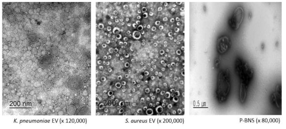 그람 음성, 그람 양성균 유래 나노소포와 P-BNS의 TEM image