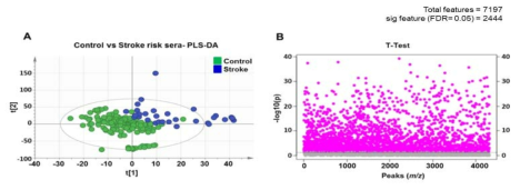 PLS-DA와 Manhattan plot을 이용한 정상인 그룹 vs 뇌졸중(Stroke) 환자 그룹 혈청 간의 대사표현형