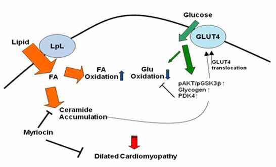 Glucose metabolism, Fatty acid oxidation, Cardiomyopathy
