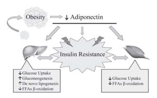 The effect of obesity on adiponectin, insulin resistance and fatty liver (Polyzos et al. Diabetes Obes Metab. 2010 May;12(5):365-83)