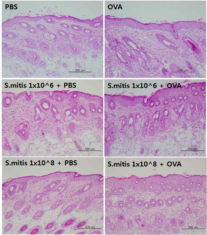 S.mitis 투여를 통한 피부 조직내 표피 두께 및 염증세포 침윤정도 비교