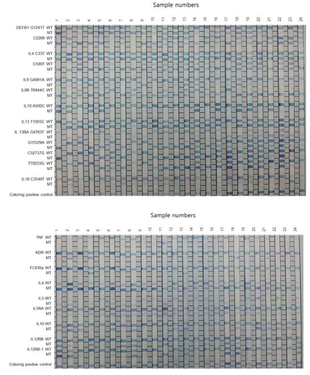 An example of REBA result in immune response related gene variations