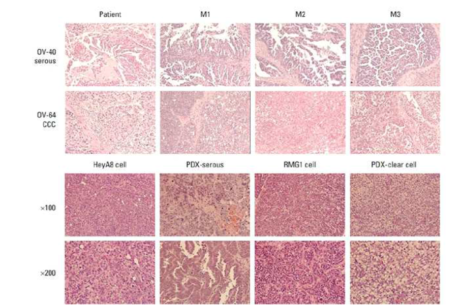 PDX 종양 조직과 암환자 종양조직의 병리 조직학적 유사성 규명