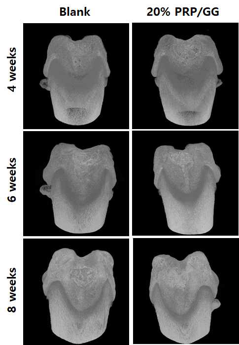 결손 연골 모델에 PRP/GG 하이드로겔 지지체에 ADSC를 파종후 in vivo 실험을 진행. 각각 수술 후 4, 6, 8주후 적출하여 micro-CT 촬영 사진