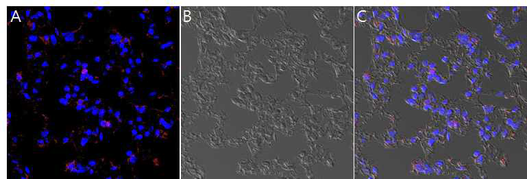 심장허혈모델에 CMSCs 주입 후 1일째에 폐사한 마우스 폐 조직. A. DiI 표지된 CMSCs (red). B. lung DIC 현미경사진. C. 병합된 이미지