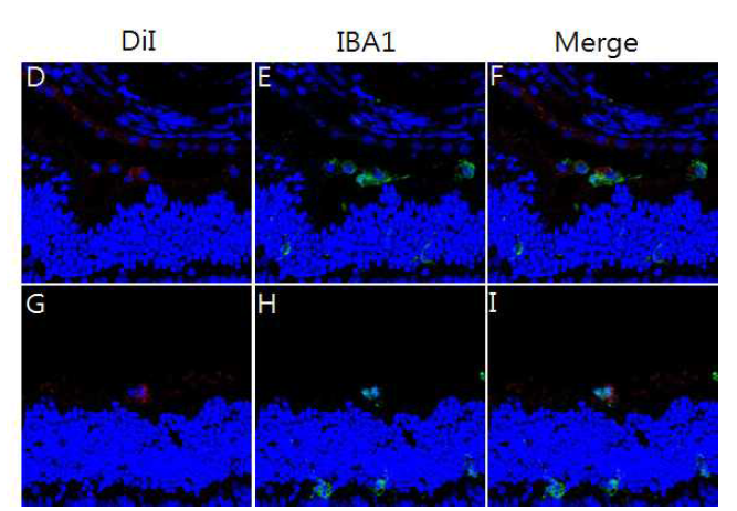 망막변성모델에 CMSCs (G-I)와 UC-MSCs (D-F) 줄기세포를 주입 한 후 3일째 얻은 망막수직절편에서 시행한 Iba1 면역형광염색 결과