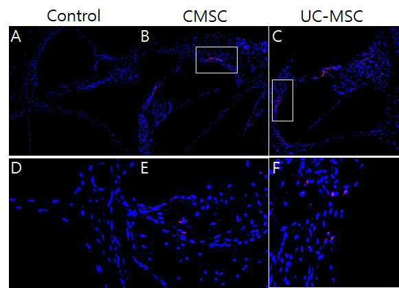 난청 마우스모델에 주입된 CMSCs와 UC-MSCs 줄기세포의 내이 내에서의 분포