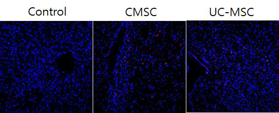 선조체 변성모델에 주입된 CMSCs와 UC-MSCs 줄기세포의 선조체 내에서의 분포