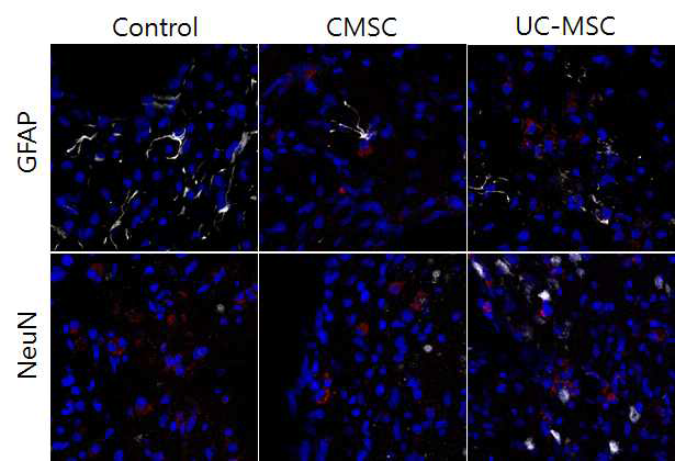 선조체 변성모델에서 CMSCs와 UC-MSCs 줄기세포를 주입 한 후 5주일째 얻은 선조체 관상절편에서 시행한 NeuN, GFAP 면역형광염색 결과