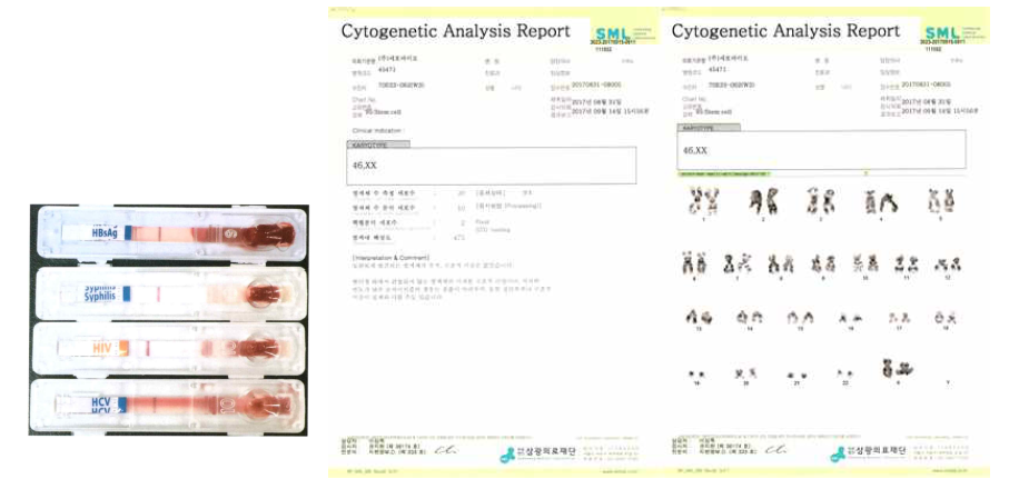 Virus Test와 염색처 이상 유무 검사