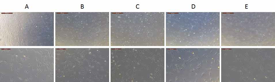 지방유래 간엽줄기세포의 Phenotype