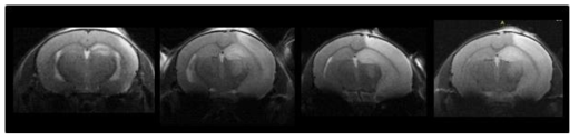 C57BL/6 쥐에서 생후 6주에 저산소-허혈성 뇌손상을 유발한 후 급성기인 3일 후 뇌졸중 동물모델들의 T2 Axial MRI image