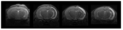 C57BL/6 쥐에서 생후 6주에 저산소-허혈성 뇌손상을 유발한 후 아급성기인 10일 후 뇌졸중 동물모델들의 T2 Axial MRI image