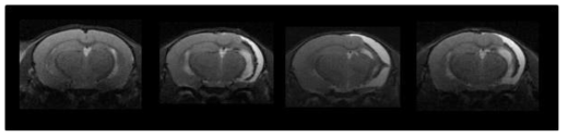 C57BL/6 쥐에서 생후 6주에 저산소-허혈성 뇌손상을 유발한 후 만성기인 4주 후 뇌졸중 동물모델들의 T2 Axial MRI image