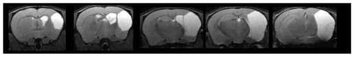 CD1(ICR) 쥐에서 생후 1주에 저산소성-허혈성 뇌손상 유발한 후 만성기 시기의 뇌졸중 동물모델의 전체적인 T2 Axial MRI image
