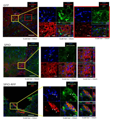 GFP-mNPCs, SPIO-RFP-mNPCs 그룹에서 이식된 세포들이 신경세포로 분화됨