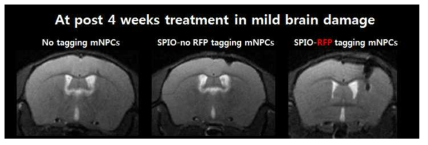 RFP 발현 세포에만 붙을 수 있는 SPIO 만 MRI에서 관찰됨
