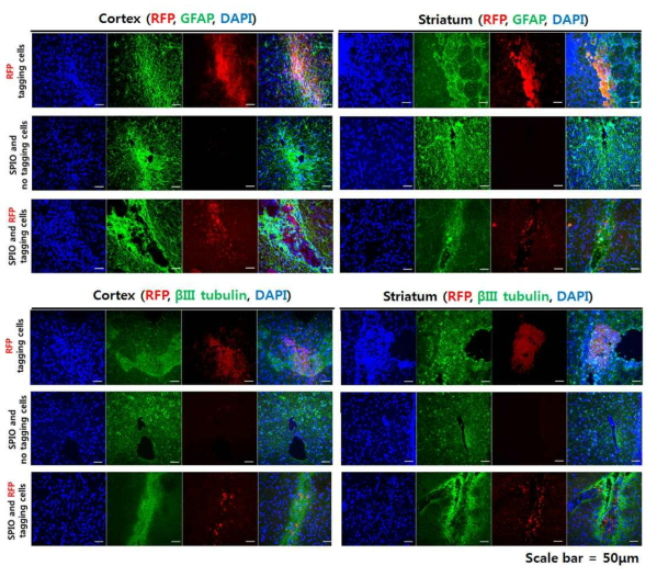 Cortex, Striatum에 이식된 세포가 신경세포 표지자 (betaIII tubulin)와 성상교세포 표지자 (GFAP)와 같이 염색됨을 확인함