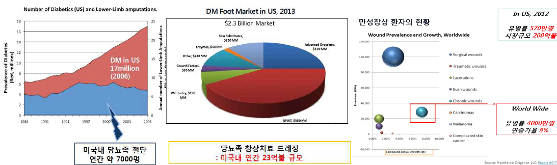 미국내 당뇨족 환자의 현황 및 창상치료 드레싱 시장 현황 및 전세계 난치성창상 환자 현황