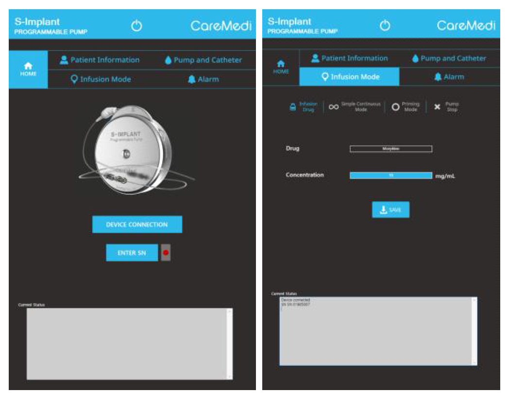 S-Implant UI 화면 이미지