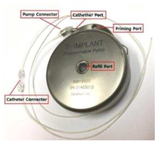 체내 이식형약물펌프(S-Implant)와 카테터