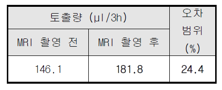 MRI 촬영 전, 후 토출 데이터 비교표