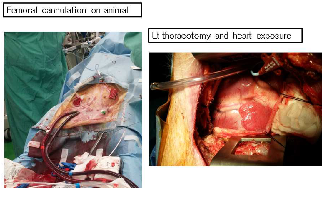 대퇴동맥으로 이용한 V-A ECMO 실험장면과 좌측 개흉술을 통한 심장 노출장면