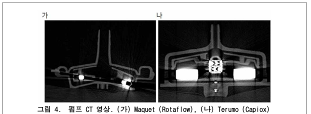 펌프 CT 영상. (가) Maquet (Rotaflow), (나) Terumo (Capiox)