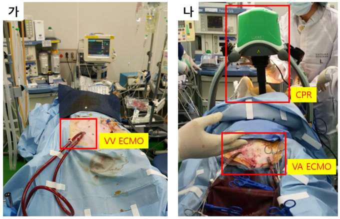 (가) dual lumen catheter을 이용한 VV(Veno-venous) ECMO 적용 동물실험. (나) 심정지 후 CPR 및 VA(veno-arterial) ECMO 적용 동물실험