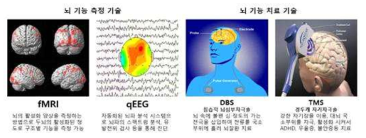 뇌 기능 측정 기술 및 치료 기술의 예