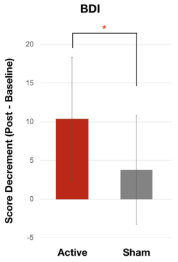 활성과 가짜 tDCS 그룹의 치료 전후 BDI 점수 변화
