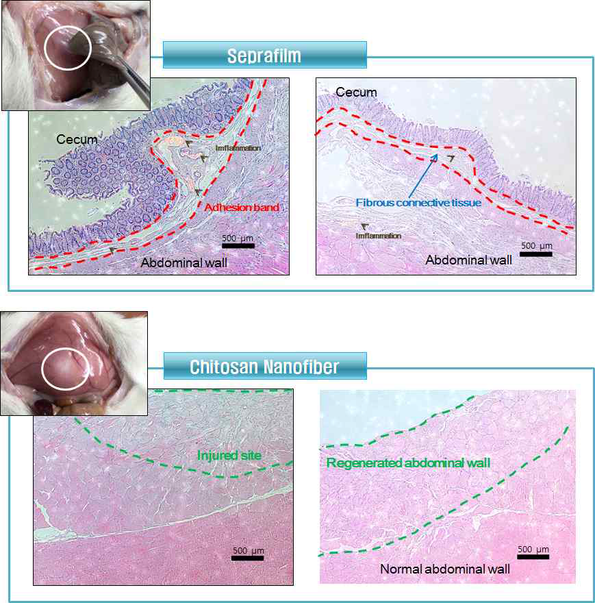 대조군(Seprafilm)과 키토산 나노섬유 조직평가