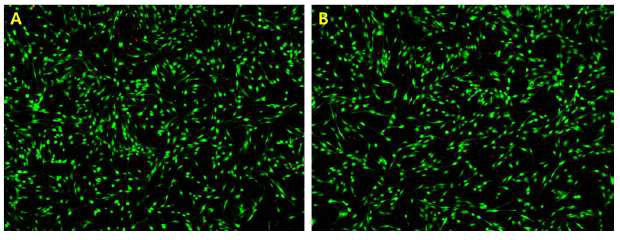 유착방지제의 용출물 세포독성 시험 후 Live/Dead 형광 염색