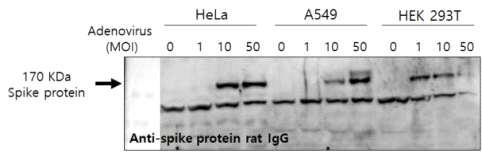 HeLa, A549, HEK 293T 세포에서 spike protein 확인