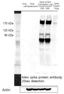 HEK 293T 세포에서 spike protein 확인