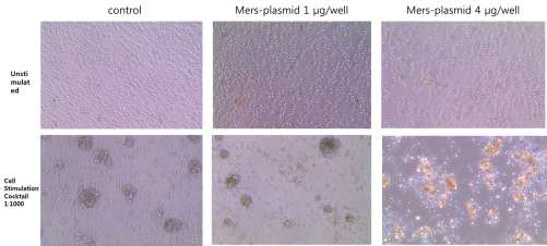 비장세포에서 morphology 변화