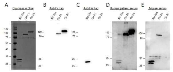 정제한 재조합 단백을 tag을 인지하는 항체 및 감염 혈청을 이용하여 항원 유효성 검증함 (A) Coomassie Blue 염색 결과, (B) anti-Fc tag 항체, (C) anti-His tag 항체, (D) SFTS 환자 혈청, (E) SFTS 바이러스 감염 마우스 혈청