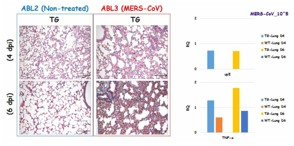 Lung inflammation and pulmonary fibrosis due to the infection with MERS-CoV is preceded by monocyte/macrophage activation and extracellular matrix remodeling