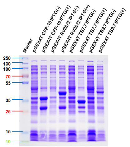 재조합 결핵 특이 항원 단백질 발현을 확인한 SDS-PAGE Gel 염색 결과
