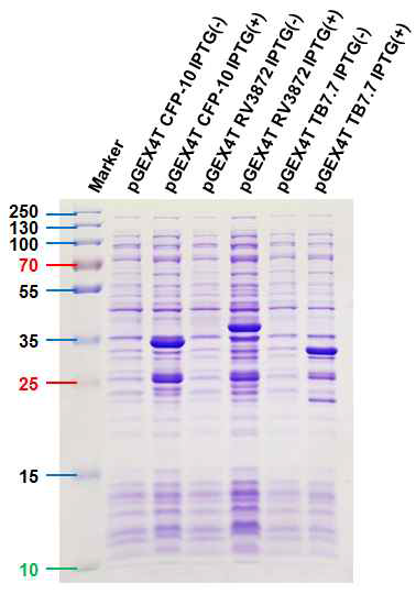 재조합 결핵 특이 항원 단백질인 CFP-10, RV3872 및 TB7.7의 발현을 확인한 SDS-PAGE 결과
