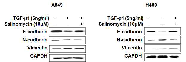 Salinomycin의 EMT 억제효과에 대한 western blotting 결과