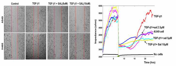 Salinomycin의 폐암세포 이동성 억제효과에 대한 scratch wound healing assay와 ECIS 결과