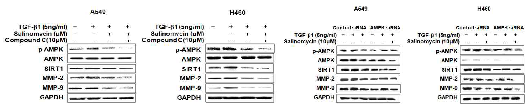 AMPK 억제 후 AMPK, SIRT1, MMP-2,-9의 단백질 발현변화