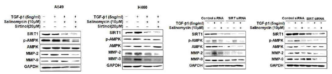SIRT1 억제 후 AMPK, SIRT1, MMP-2,-9의 단백질 발현변화