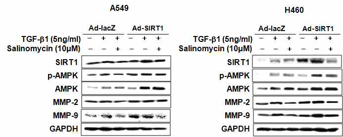 SIRT1 과발현 후 AMPK, SIRT1, MMP-2,-9의 단백질 발현변화